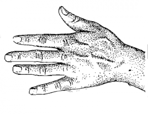 Artist: Warren Oddsson Date: 1990 License: CC BY-SA 4.0 Drawing of a human hand.
